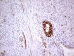 ABCB1 Antibody in Immunohistochemistry (Paraffin) (IHC (P))