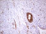 ABCB1 Antibody in Immunohistochemistry (Paraffin) (IHC (P))