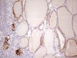 ABCB1 Antibody in Immunohistochemistry (Paraffin) (IHC (P))