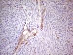 ABCB1 Antibody in Immunohistochemistry (Paraffin) (IHC (P))