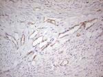 ABCB1 Antibody in Immunohistochemistry (Paraffin) (IHC (P))