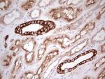 ABCB1 Antibody in Immunohistochemistry (Paraffin) (IHC (P))