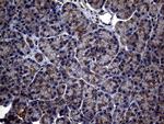 ABCB1 Antibody in Immunohistochemistry (Paraffin) (IHC (P))