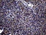 ABCB1 Antibody in Immunohistochemistry (Paraffin) (IHC (P))