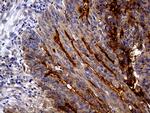 ABCB1 Antibody in Immunohistochemistry (Paraffin) (IHC (P))