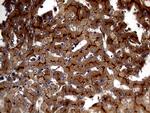 ABCB1 Antibody in Immunohistochemistry (Paraffin) (IHC (P))