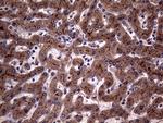 ABCB1 Antibody in Immunohistochemistry (Paraffin) (IHC (P))