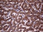 ABCB1 Antibody in Immunohistochemistry (Paraffin) (IHC (P))