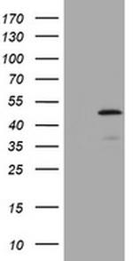 ABCB1 Antibody in Western Blot (WB)