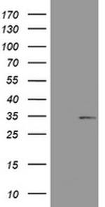 ABCB1 Antibody in Western Blot (WB)