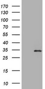 ABCB1 Antibody in Western Blot (WB)