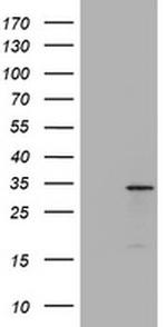 ABCB1 Antibody in Western Blot (WB)