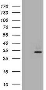 ABCB1 Antibody in Western Blot (WB)