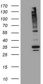 ABCB1 Antibody in Western Blot (WB)