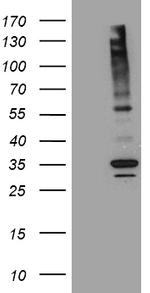 ABCB1 Antibody in Western Blot (WB)