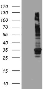 ABCB1 Antibody in Western Blot (WB)