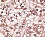 ABCB4 Antibody in Immunohistochemistry (IHC)