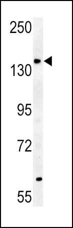 ABCB4 Antibody in Western Blot (WB)