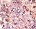 ABCB7 Antibody in Immunohistochemistry (IHC)