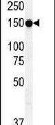 MRP7 Antibody in Western Blot (WB)