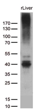 ABCC2 Antibody in Western Blot (WB)