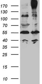 ABCC2 Antibody in Western Blot (WB)