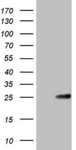 ABCC5 Antibody in Western Blot (WB)