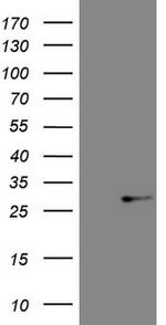 ABCC5 Antibody in Western Blot (WB)