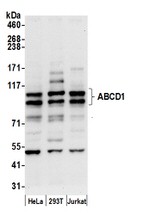 ABCD1 Antibody in Western Blot (WB)