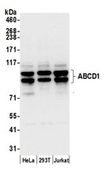 ABCD1 Antibody in Western Blot (WB)