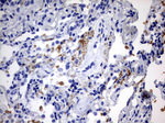 ABCD1 Antibody in Immunohistochemistry (Paraffin) (IHC (P))
