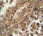 ABCG1 Antibody in Immunohistochemistry (IHC)