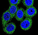 ABCG1 Antibody in Immunocytochemistry (ICC/IF)
