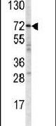 ABCG1 Antibody in Western Blot (WB)