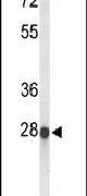 ABHDB Antibody in Western Blot (WB)