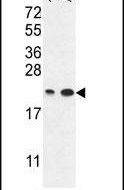 ABHEB Antibody in Western Blot (WB)