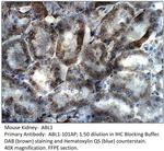 ABL1 Polyclonal Antibody