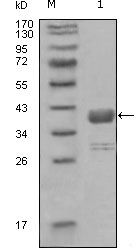 c-Abl Monoclonal Antibody (7B11D6)