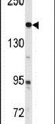 c-Abl Antibody in Western Blot (WB)