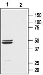 Bombesin Receptor 3 (extracellular) Antibody in Western Blot (WB)
