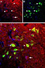 B2 Bradykinin Receptor (BDKRB2) Polyclonal Antibody