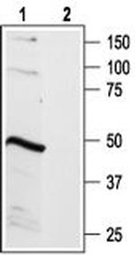 B2 Bradykinin Receptor (BDKRB2) Antibody in Western Blot (WB)