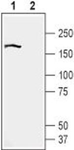 BAI2 (extracellular) Polyclonal Antibody