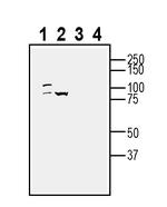 BMPR1A (extracellular) Antibody in Western Blot (WB)