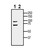 BMPR1A (extracellular) Antibody in Western Blot (WB)