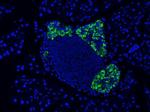 GLP-1 Monoclonal Antibody (4)