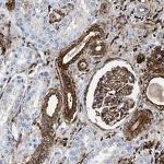 Gelsolin Antibody in Immunohistochemistry (Paraffin) (IHC (P))