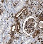 Gelsolin Antibody in Immunohistochemistry (Paraffin) (IHC (P))