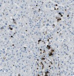 FCN1 Monoclonal Antibody (1)