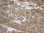 ACADM Antibody in Immunohistochemistry (Paraffin) (IHC (P))
